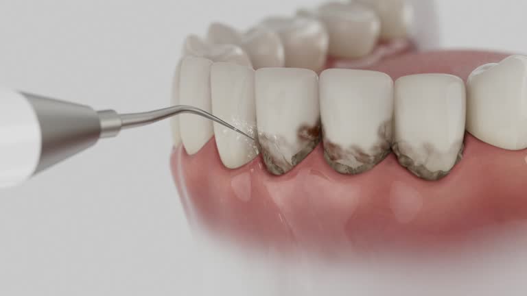 Trusted Dental Crowns And Bridges service in Woodbury Heights, NJ - Dentist Open Now